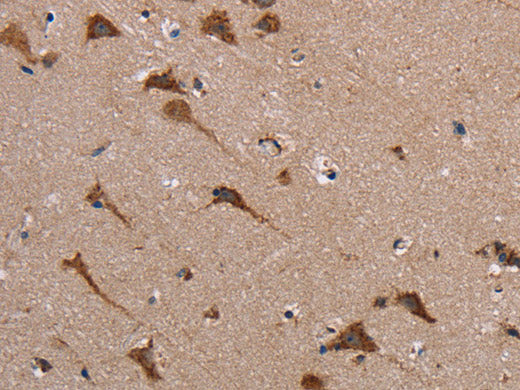 POMT1 Polyclonal Antibody Store at -20°C