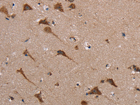POMT1 Polyclonal Antibody Store at -20°C