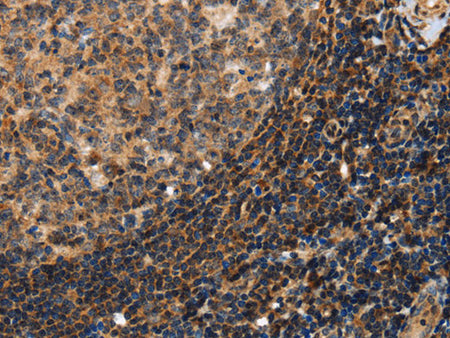 PON1 Polyclonal Antibody Store at -20°C