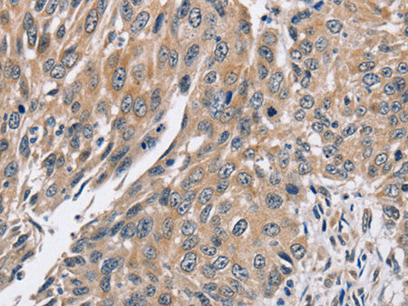 PPP1CC Polyclonal Antibody Store at -20°C