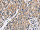 PPP1CC Polyclonal Antibody Store at -20°C