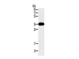 PPP1CC Polyclonal Antibody Store at -20°C