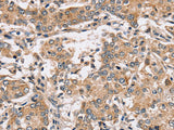 PPP1CC Polyclonal Antibody Store at -20°C