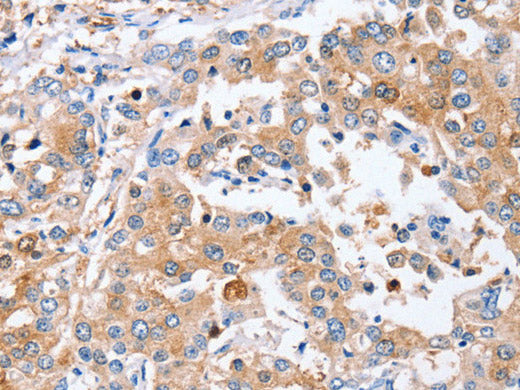 PPOX Polyclonal Antibody Store at -20°C