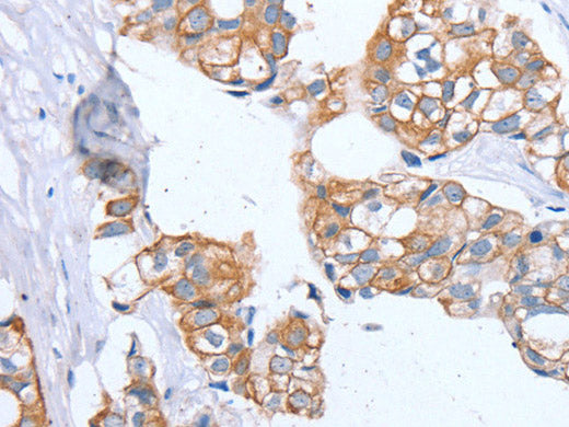 PTP4A2 Polyclonal Antibody Store at -20°C