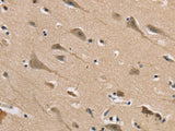 DLG2 Polyclonal Antibody