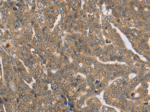 PTPN12 Polyclonal Antibody Store at -20°C