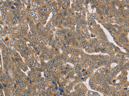 PTPN12 Polyclonal Antibody Store at -20°C
