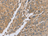 PTPN12 Polyclonal Antibody Store at -20°C