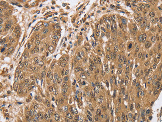 PTPN20 Polyclonal Antibody Store at -20°C