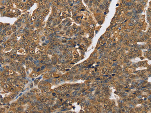 PTPN20 Polyclonal Antibody Store at -20°C