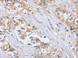 PTPN4 Polyclonal Antibody Store at -20°C