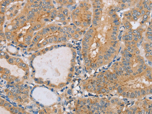 PTPN4 Polyclonal Antibody Store at -20°C