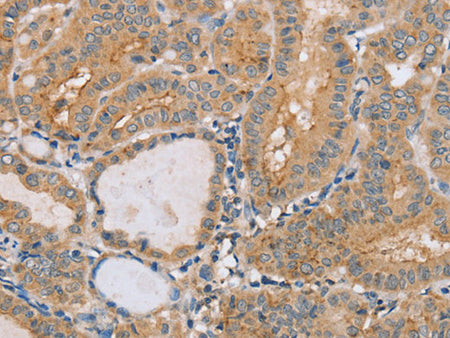 PTPN4 Polyclonal Antibody Store at -20°C