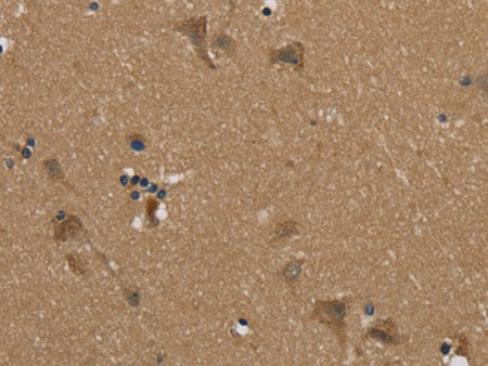 PUS10 Polyclonal Antibody