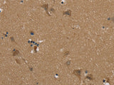 PUS10 Polyclonal Antibody