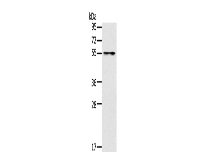 PUS10 Polyclonal Antibody