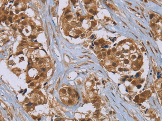 PUS10 Polyclonal Antibody