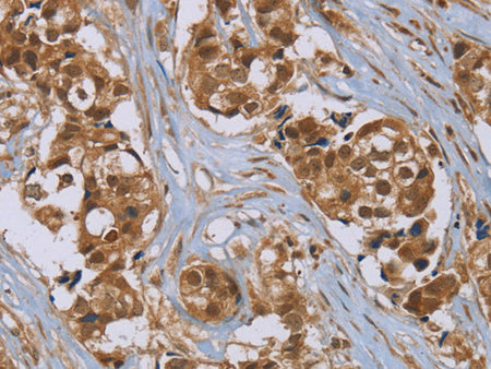 PUS10 Polyclonal Antibody