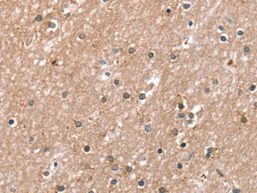 RAB8A Polyclonal Antibody
