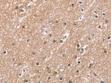 RAB8A Polyclonal Antibody