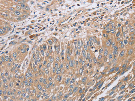 RAB8B Polyclonal Antibody Store at -20°C