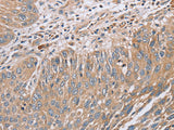 RAB8B Polyclonal Antibody Store at -20°C