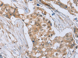 RAB8B Polyclonal Antibody Store at -20°C