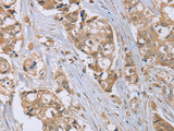 RAB6C Polyclonal Antibody