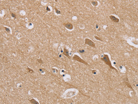 RAB6C Polyclonal Antibody