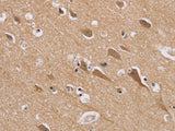 RAB6C Polyclonal Antibody