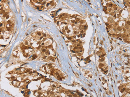 RAB24 Polyclonal Antibody Store at -20°C