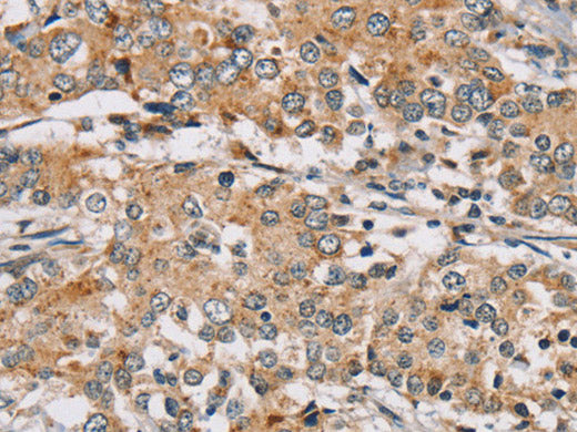 RAB24 Polyclonal Antibody Store at -20°C