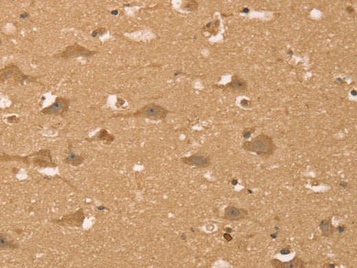HIF1AN Polyclonal Antibody