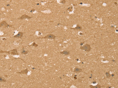 HIF1AN Polyclonal Antibody