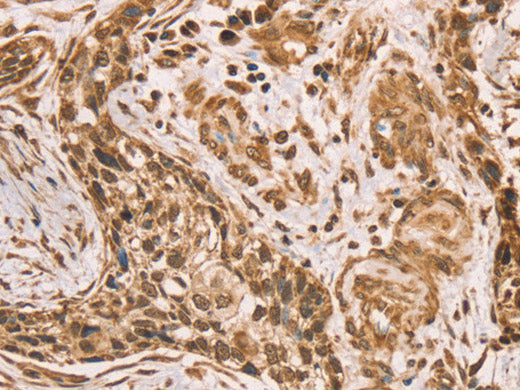 HIF1AN Polyclonal Antibody