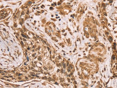 HIF1AN Polyclonal Antibody