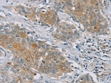 RASA2 Polyclonal Antibody