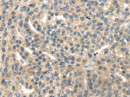 RASA2 Polyclonal Antibody