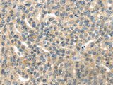 RASA2 Polyclonal Antibody
