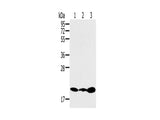 RNF5 Polyclonal Antibody Store at -20°C