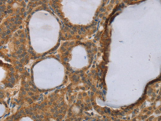 RNF5 Polyclonal Antibody Store at -20°C