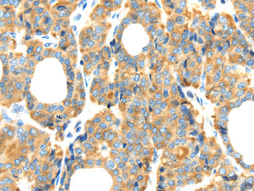 RIPK4 Polyclonal Antibody Store at -20°C