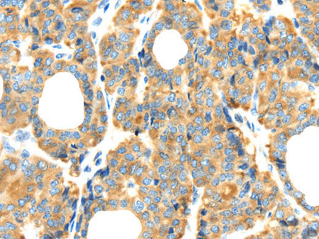 RIPK4 Polyclonal Antibody Store at -20°C
