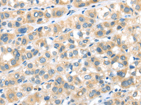 RIPK4 Polyclonal Antibody Store at -20°C