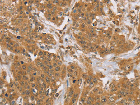KCNJ15 Polyclonal Antibody Store at -20°C