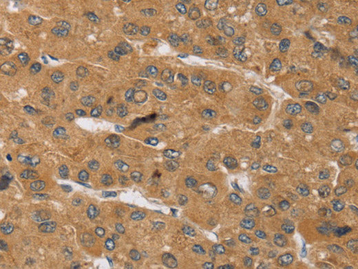 KCNJ15 Polyclonal Antibody Store at -20°C