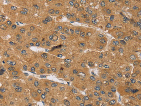 KCNJ15 Polyclonal Antibody Store at -20°C