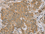 RNF148 Polyclonal Antibody Store at -20°C