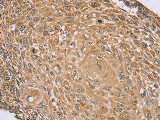 RNF148 Polyclonal Antibody Store at -20°C
